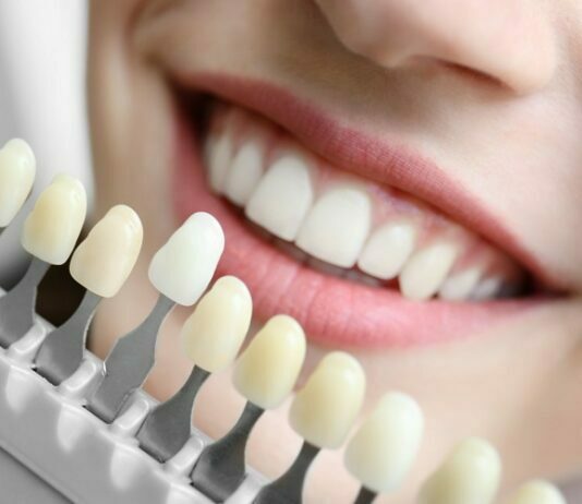 Why Teeth Whitening Phuket Will Change Your Life Teeth Whitening